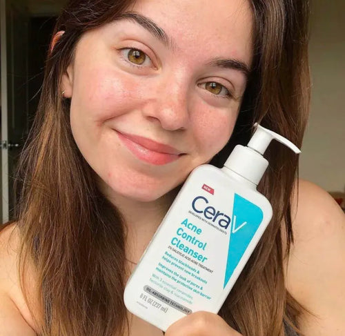 Acne Control Face Wash – Oil Free Deep Cleansing, Anti Acne, Pimples & Dark Spots Removal,