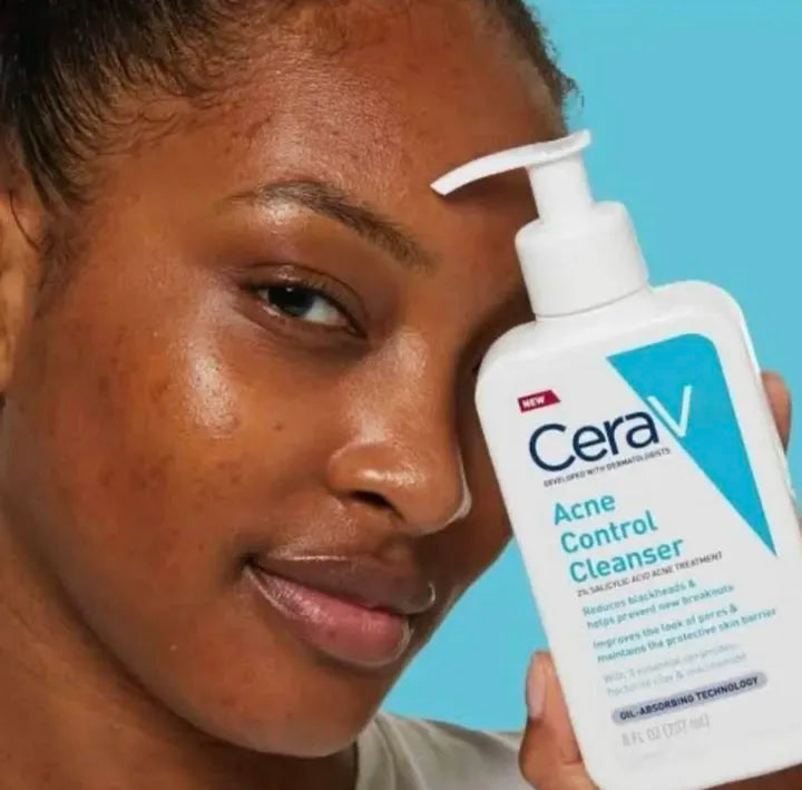 Acne Control Face Wash – Oil Free Deep Cleansing, Anti Acne, Pimples & Dark Spots Removal,